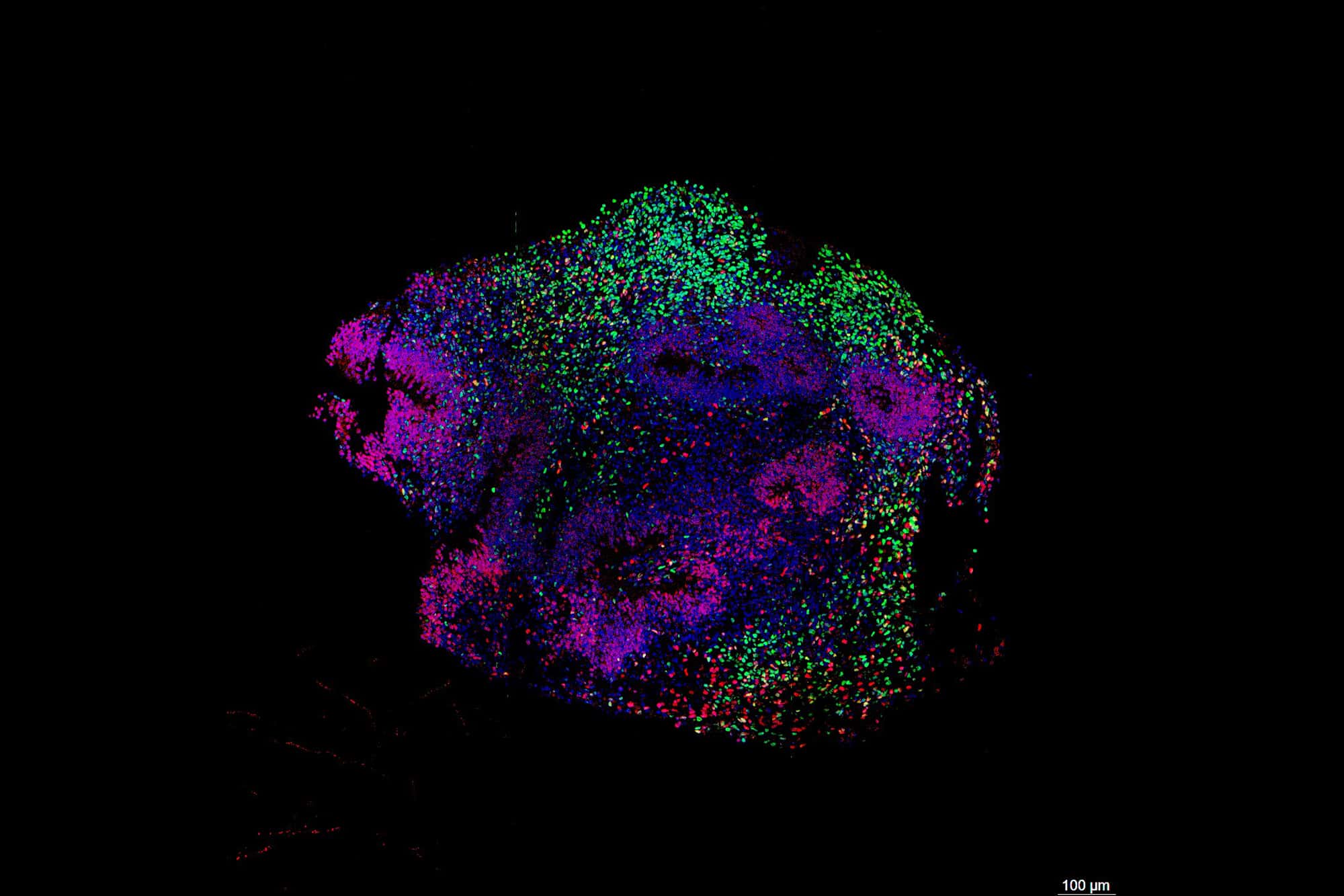 UCLA Stem Cell Models Replicate Anesthesia Brain Waves